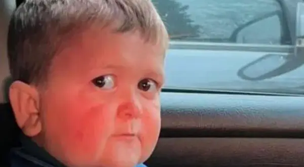 Ile lat ma Hasbulla? Zaskakująca prawda o jego wieku i wyglądzie